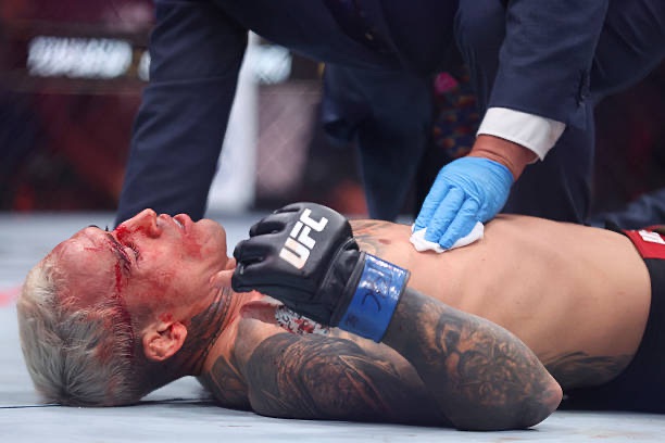 Is Charles Oliveira Returning Too&nbsp;Soon?